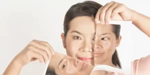 Como eliminar el melasma definitivamente